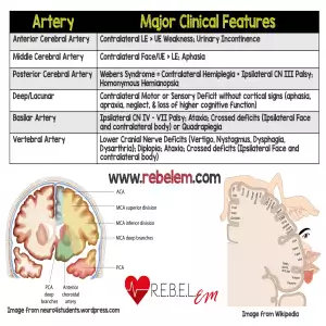 REBELEM Stroke Syndromes